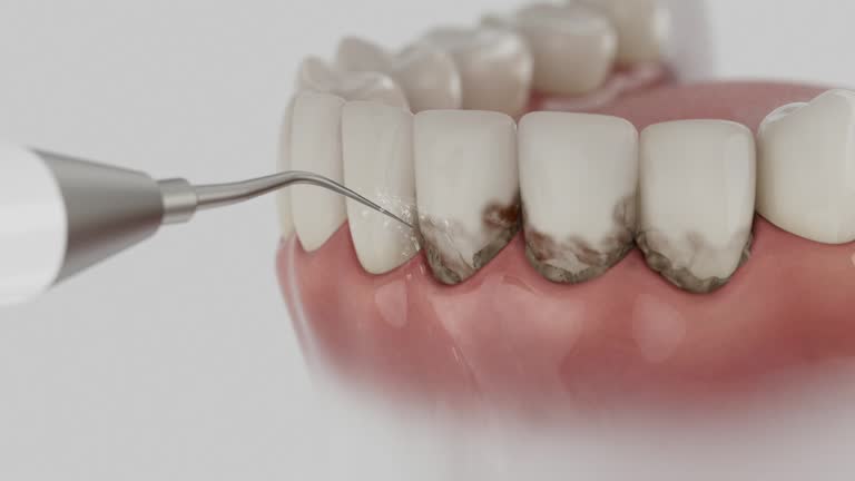Reliable Teeth Cleaning And Checkup contractor in Webster, TX by Smile Center Dentistry
